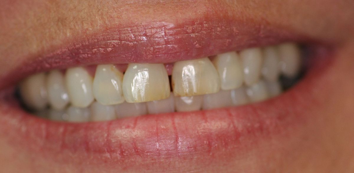 Gallery Country Club Dental Care